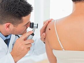 your doctor will examine your papilloma for recommended removal with medication